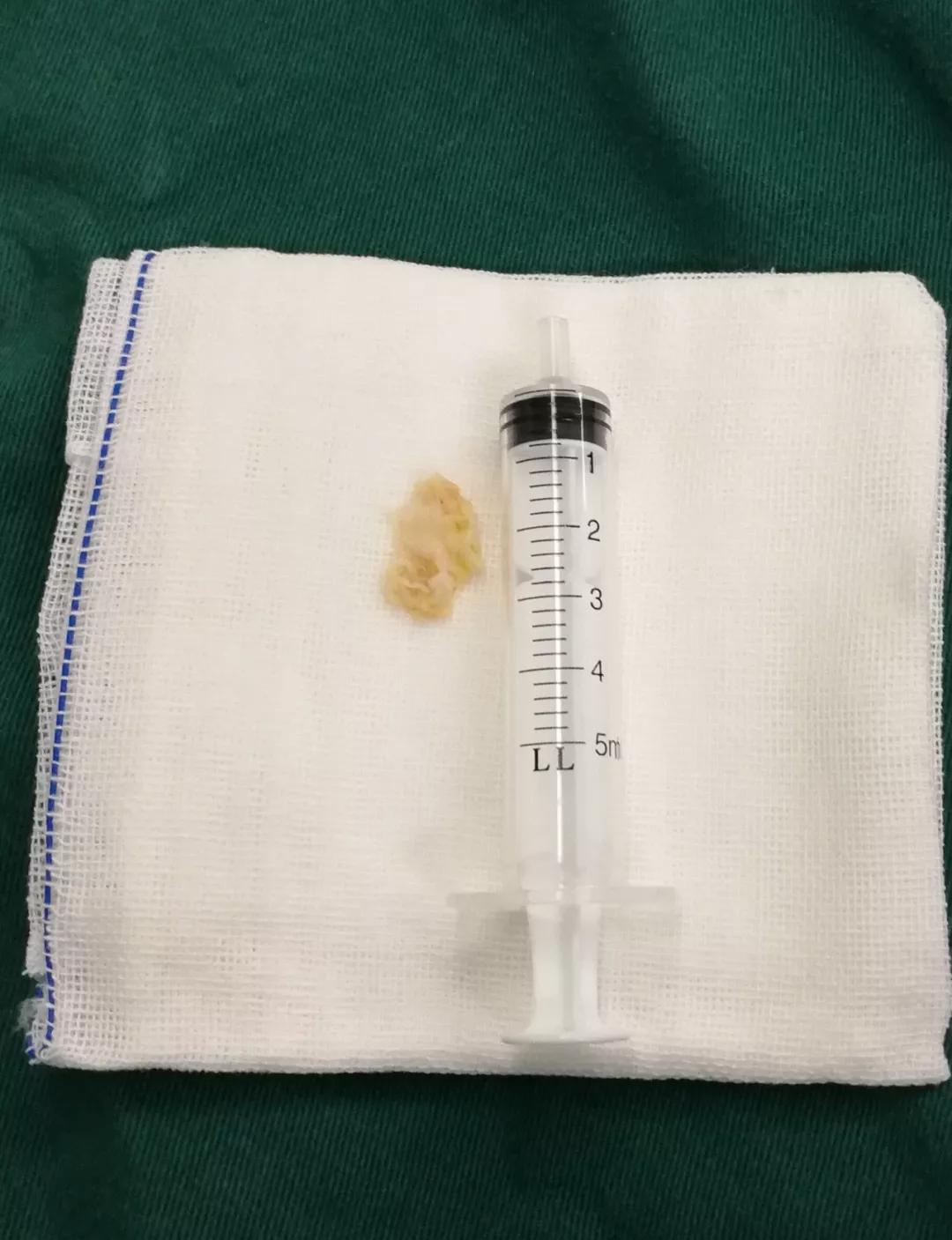 21点游戏规则